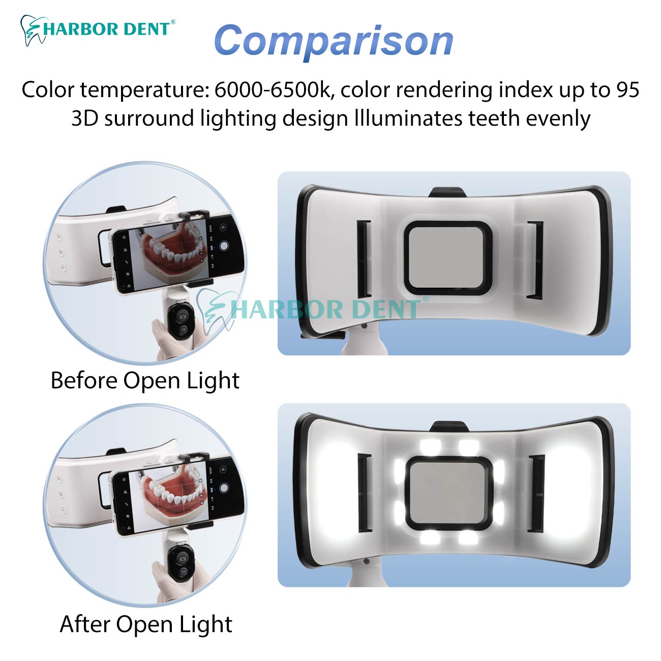 좋은 가격의 치과 사진 촬영용 모바일 조명, 밝기 조절 - Good Lighting In Photography 리뷰 및 가격