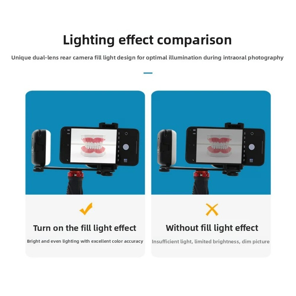치과 사진 촬영 조명, 스마트폰용 블루투스 LED 플래 - Photography Lighting Basics 리뷰 및 가격
